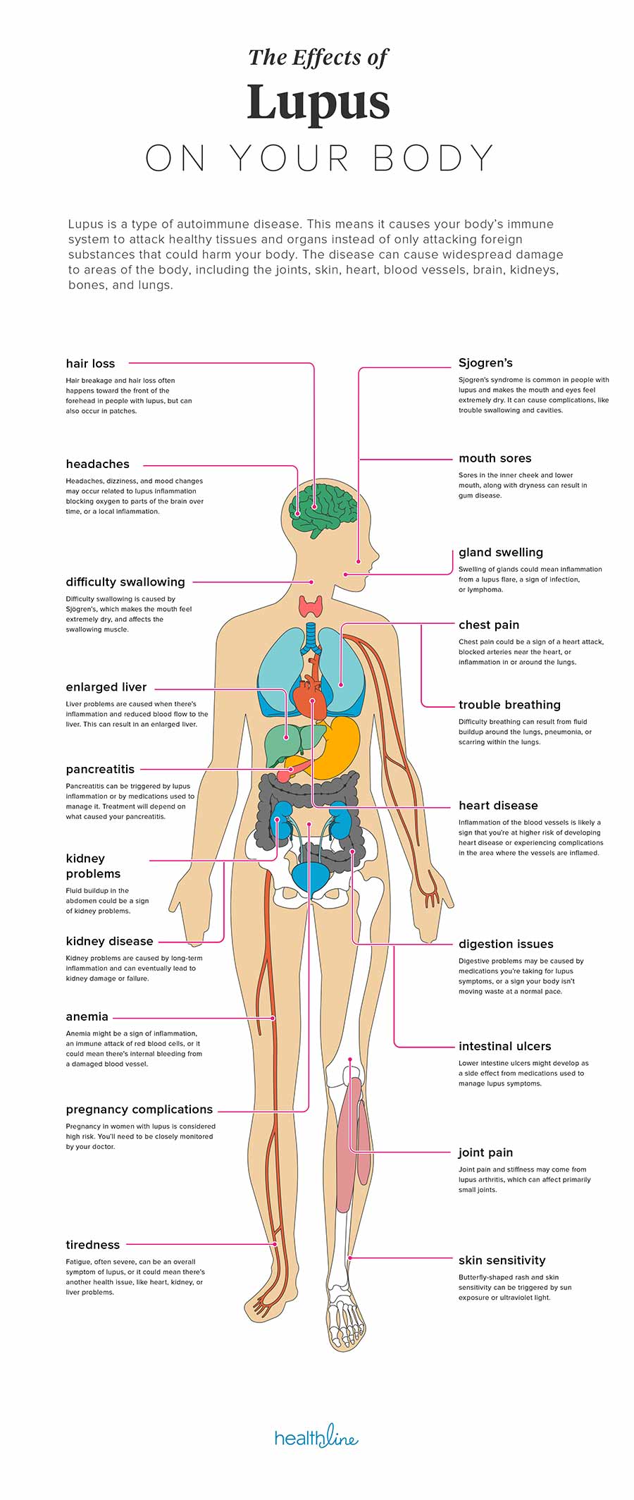 The effects of Lupus on the body - Healthline