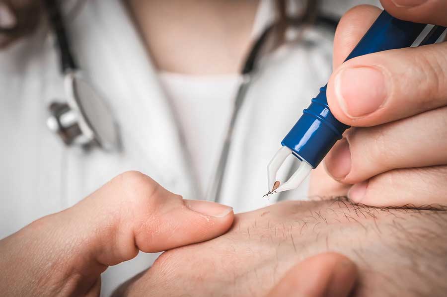 A doctor carefully removes a tick from someone's hand