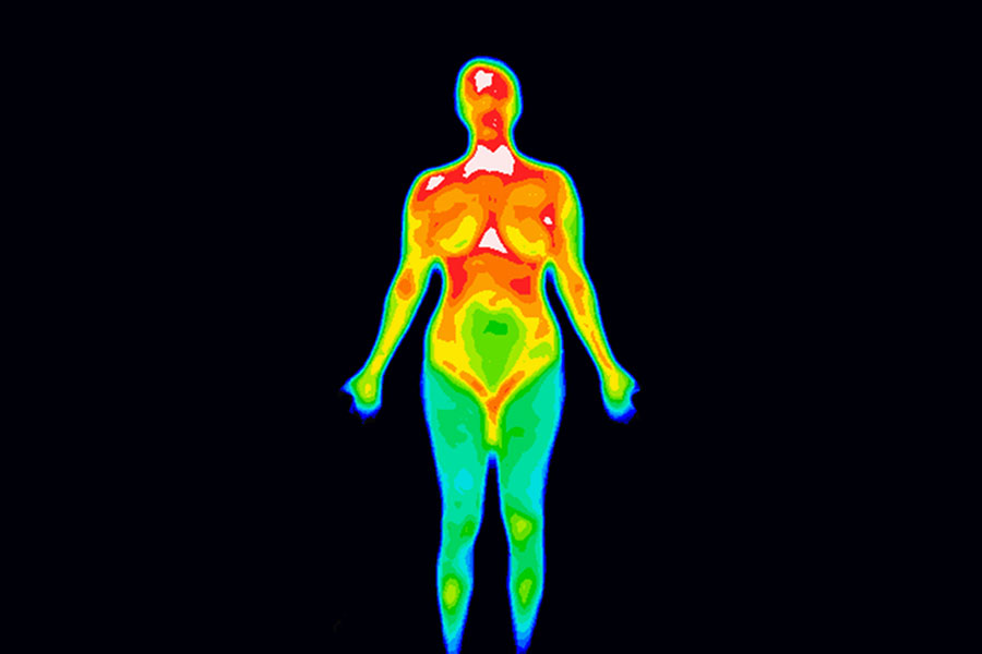 A thermographic image of a woman with breast cancer