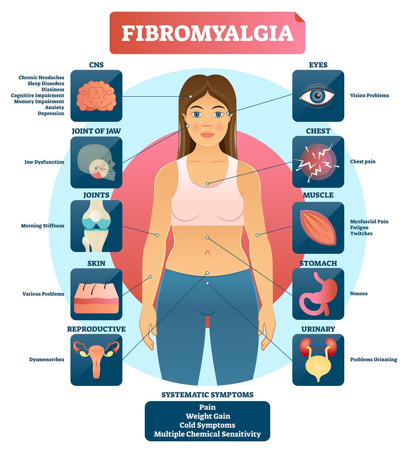 Fibromyalgia Infographic