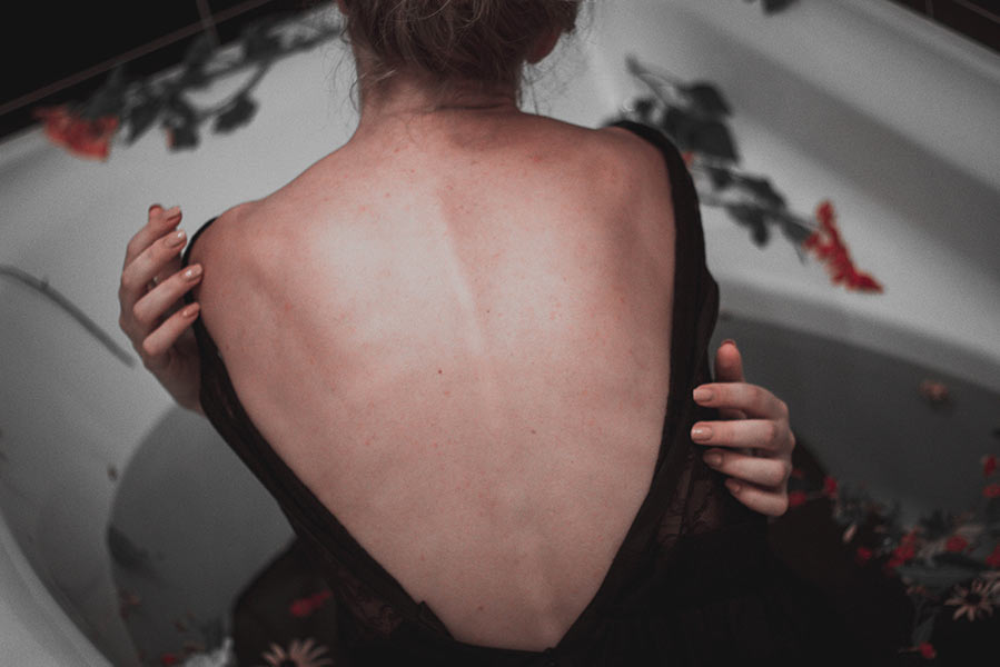 A woman with fibromyalgia pain in her back