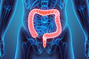 Inflammatory Bowel Disease: The Most Common Complications of the Condition