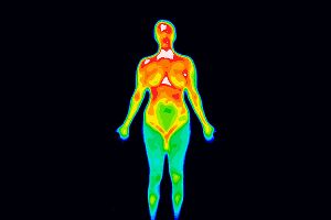 The Truth About Breast Thermography